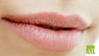 Natürliche Lippenvergrößerung mit Hyaluronsäure